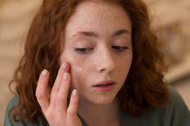 Laser treatments